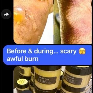 MIRACLE 👑 HEALING ❤️‍🩹 BALM Healing Skin Salve - 5 ⭐️ RATED EST 2017